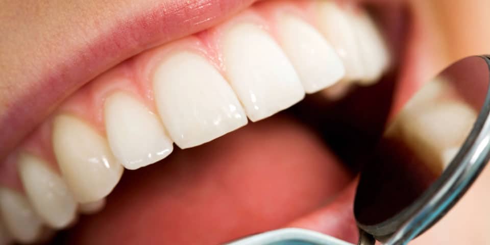 Manhattan KS Dental Cleanings and Exams Image - Bowen Family Dentistry